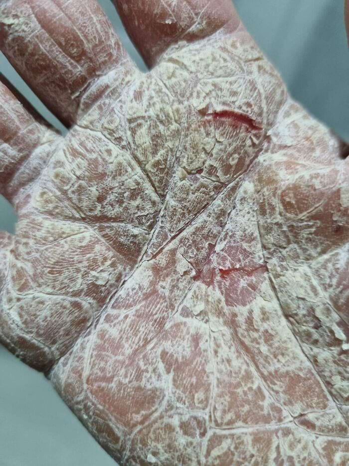 image-20250903144030-15