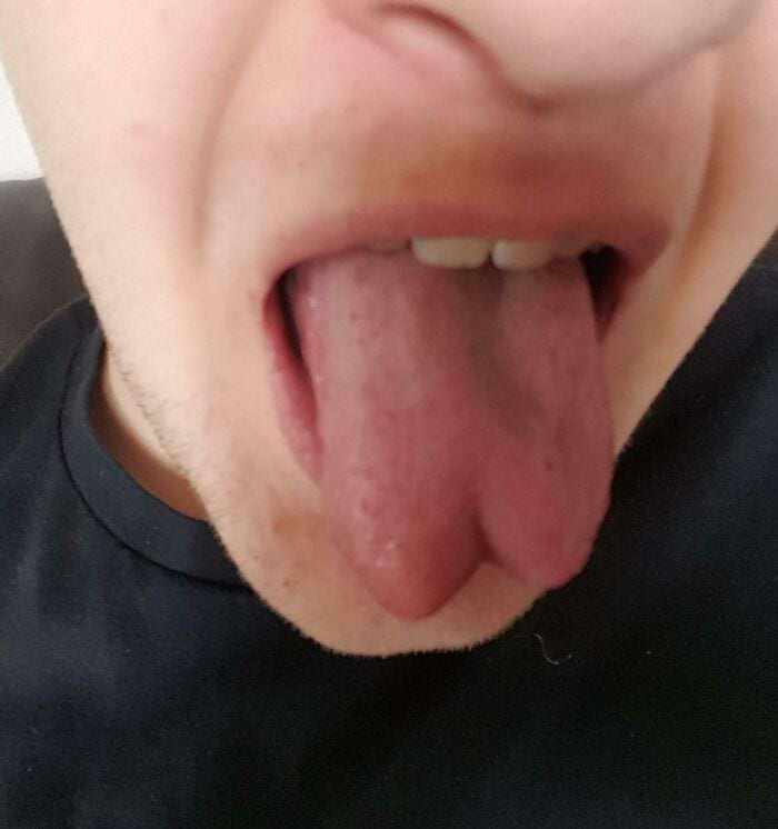 image-20250903144036-17