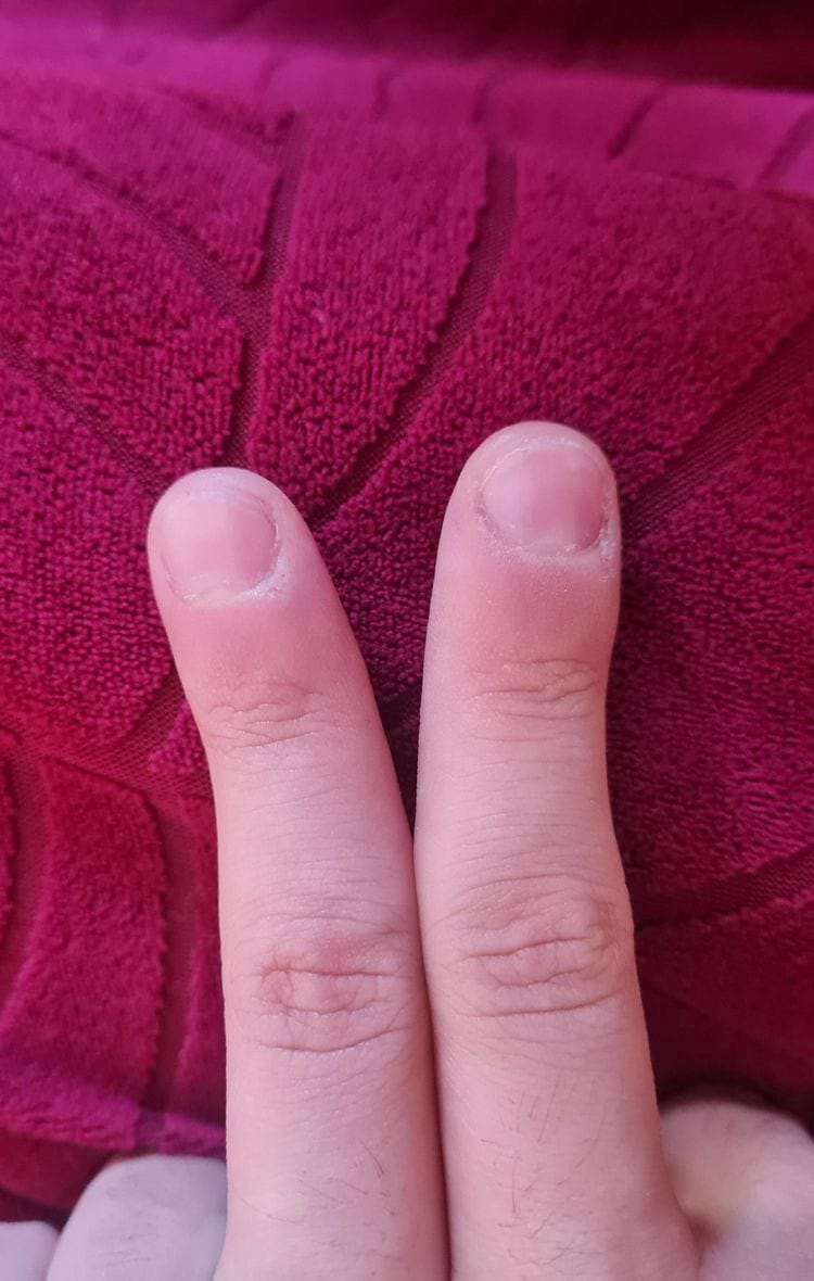 кривые указательные пальцы