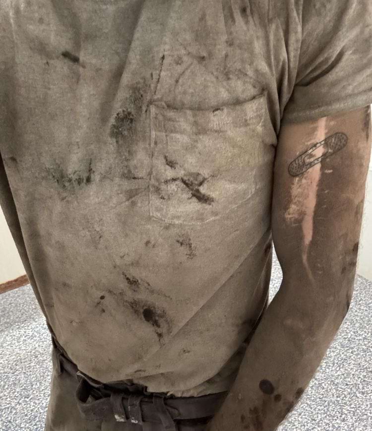 на шраме на руке не прилипает пыль