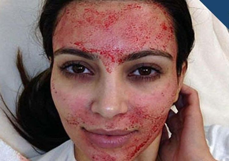 image-20251111153019-9