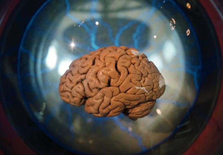 image-20251112170759-12