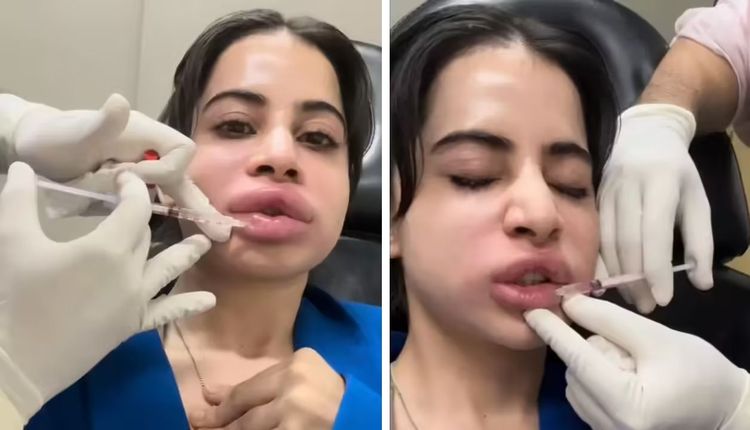 image-20251125093948-10