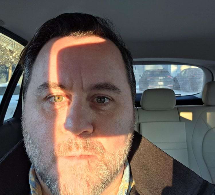 солнце светит в глаз через просвет