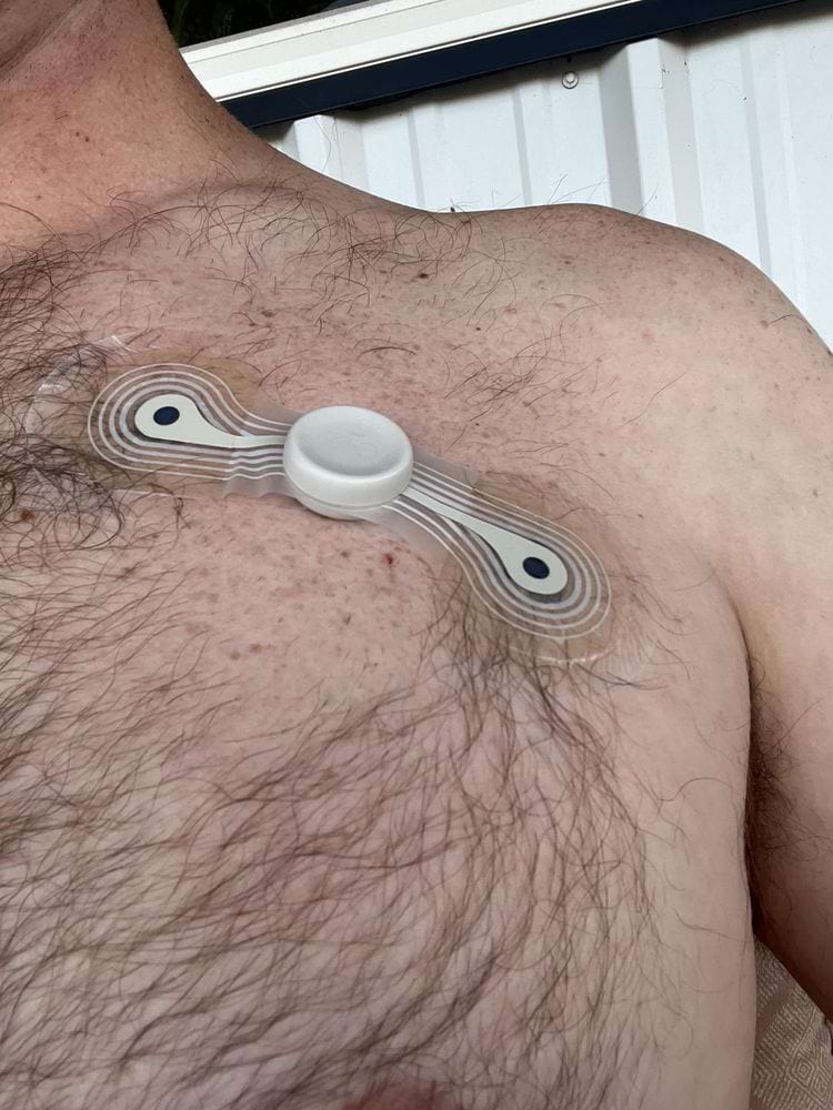 холтер на груди