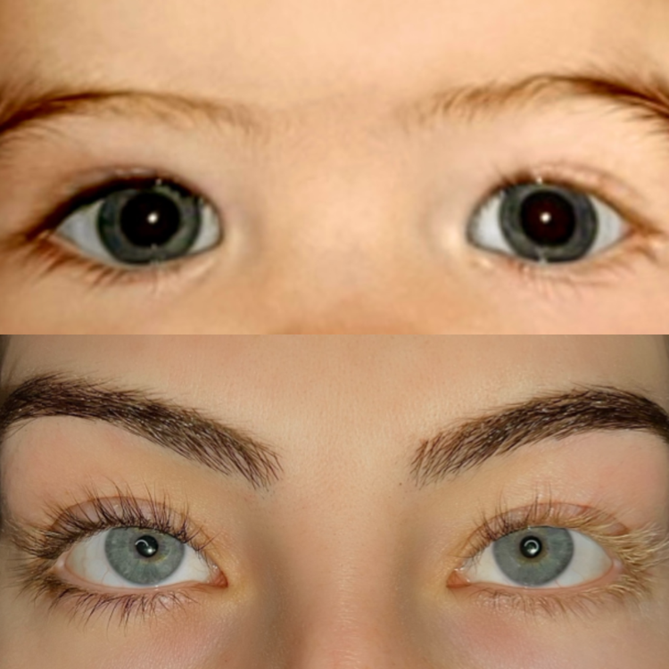 девушка с ресницами разного цвета