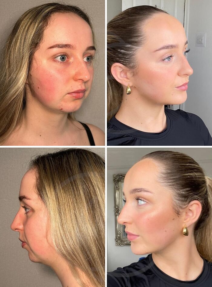 image-20251224131907-9