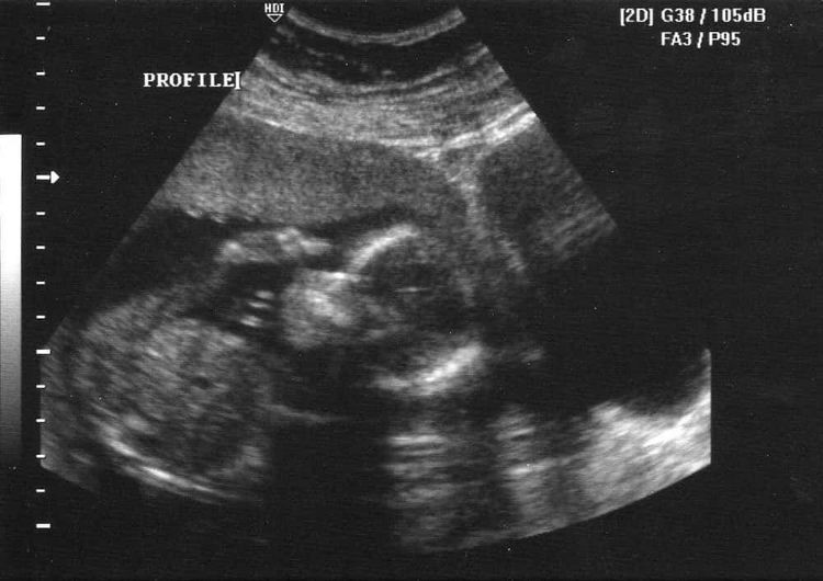 image-20260129152143-9