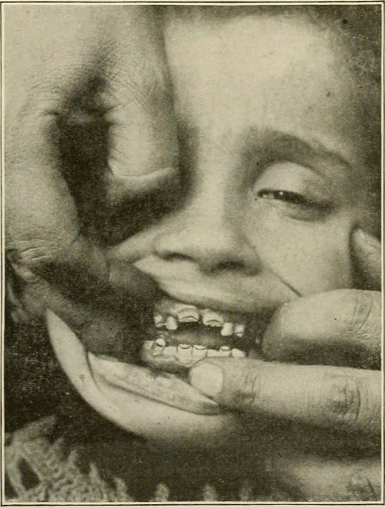 image-20260403171415-9