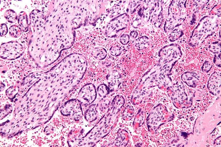 image-20260403171424-12