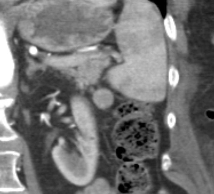 image-20260410161745-9