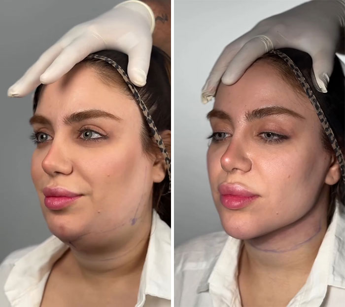 image-20260430151628-5