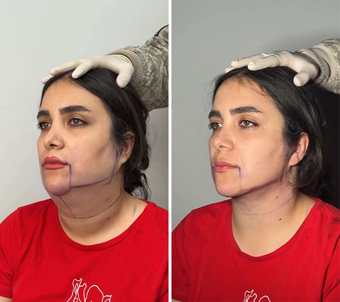 image-20260430151655-13