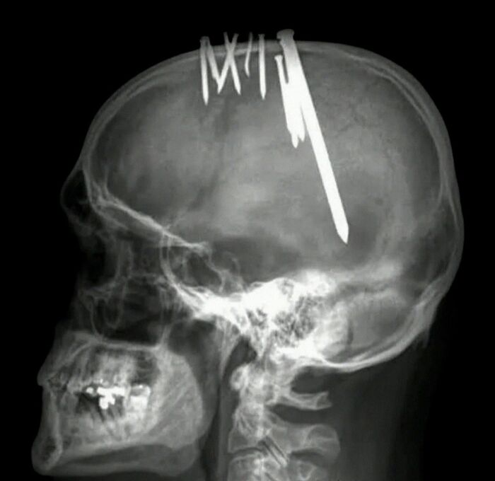 image-20260623183954-2