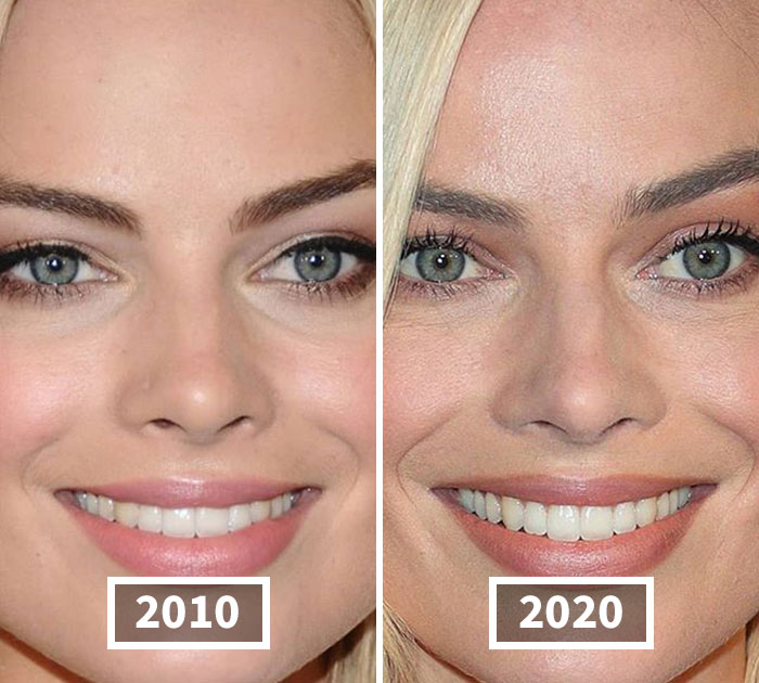 celebrities-before-and-after-instagram-5f7ee159977e8  700