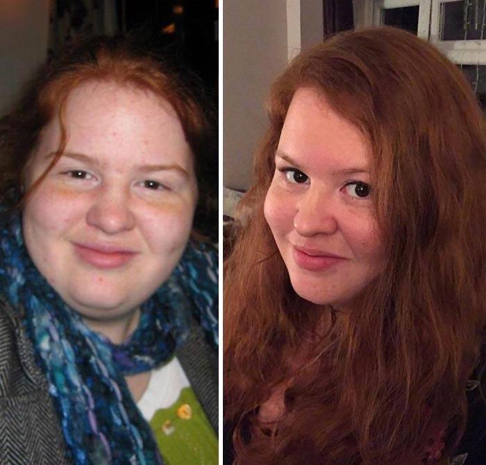 Люди делятся фотографиями с челленджа #10YearChallenge, и некоторых невозможно узнать Люди делятся фотографиями с челленджа #10YearChallenge, #10YearChallenge