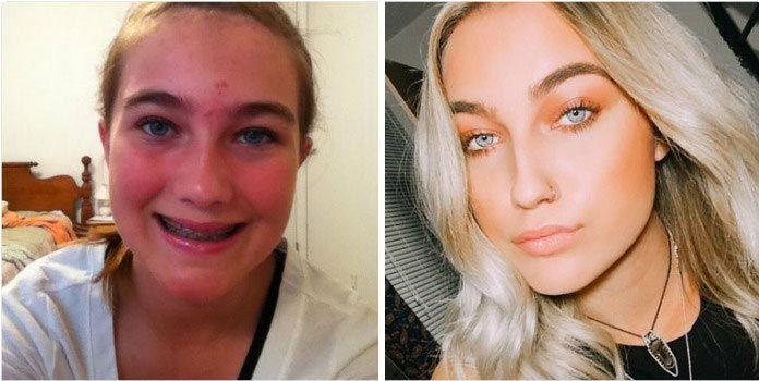 Люди делятся фотографиями с челленджа #10YearChallenge, и некоторых невозможно узнать Люди делятся фотографиями с челленджа #10YearChallenge, #10YearChallenge