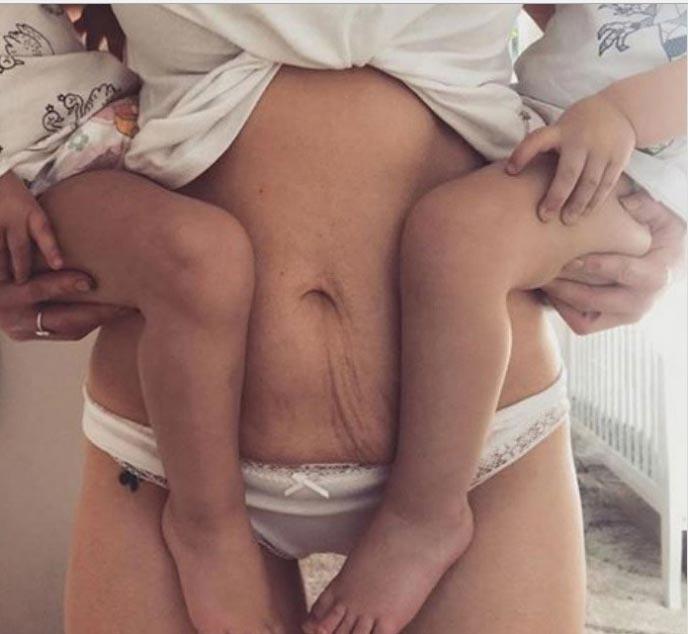 25 честных фотографий после родов, которыми делятся женщины, чтобы раскрыть правду честные фотографии после родов, женщины стали делиться честными фотографиями своих после рождения детей