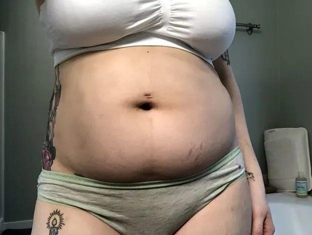 Лишний вес после родов фото