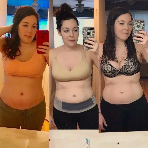 До и после похудения живот после родов фото
