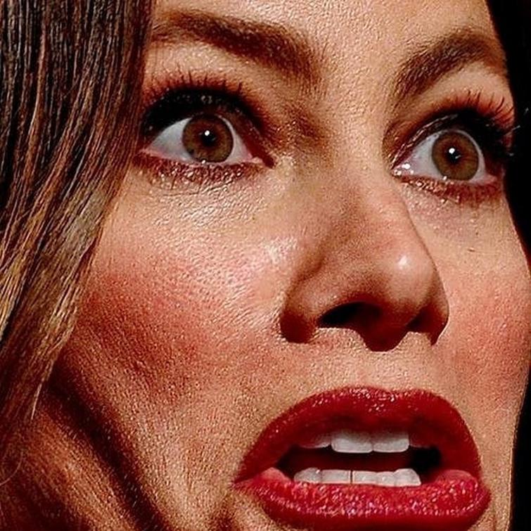 фотографии звёзд крупным планом, фотографий звёзд крупным планом, фотографии на которых видно недостатки звёзд 