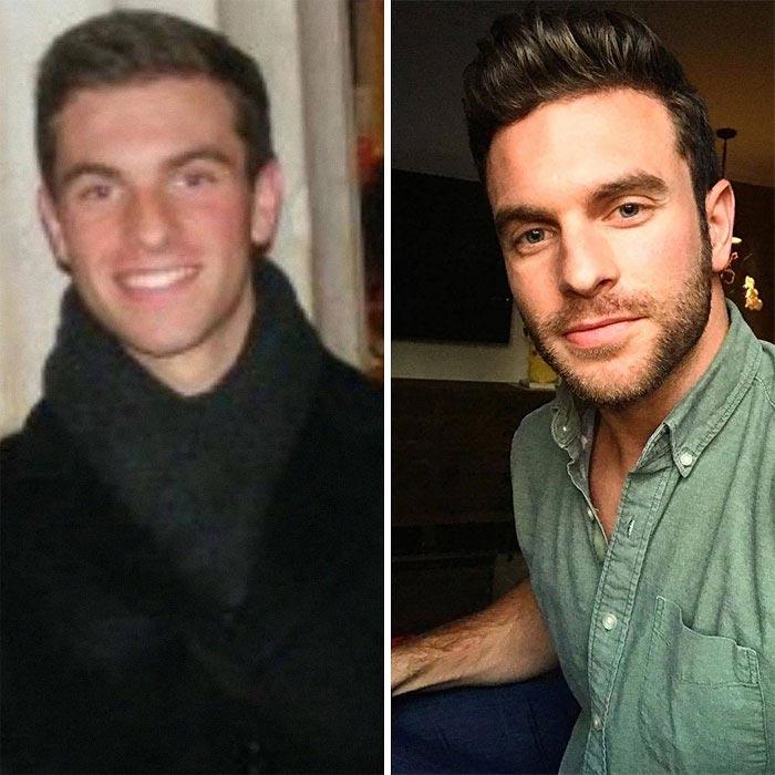 Люди делятся фотографиями с челленджа #10YearChallenge, и некоторых невозможно узнать Люди делятся фотографиями с челленджа #10YearChallenge, #10YearChallenge