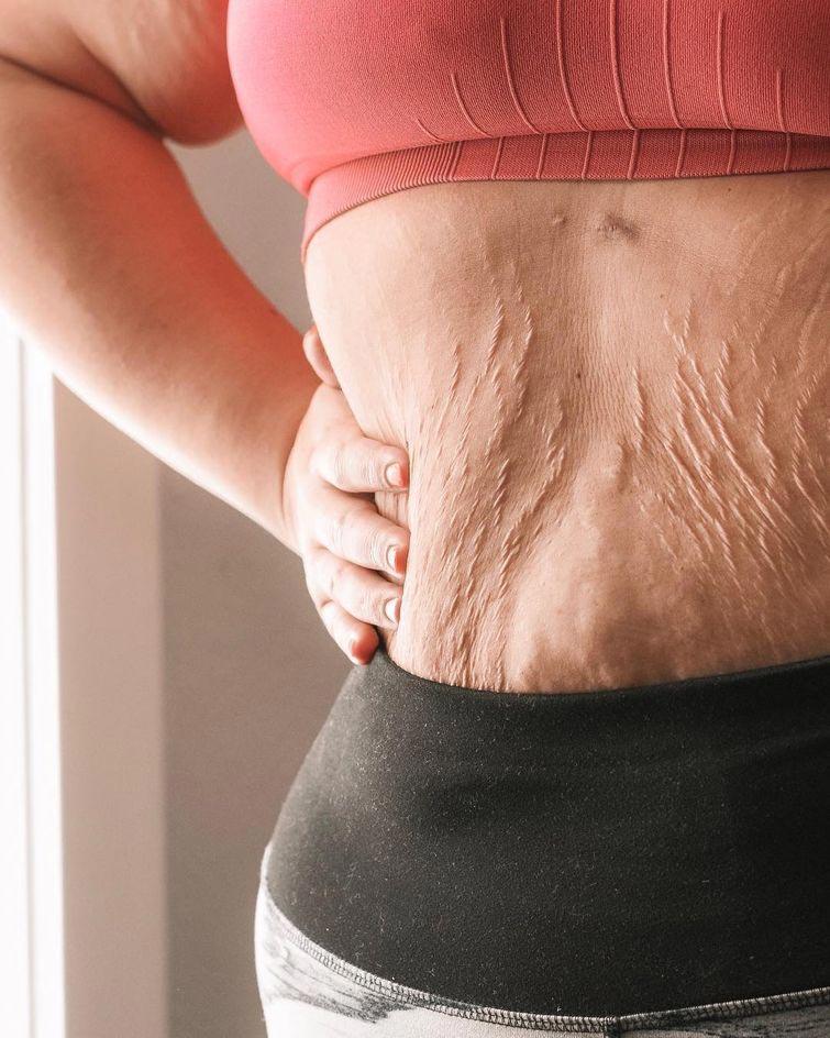 25 честных фотографий после родов, которыми делятся женщины, чтобы раскрыть правду честные фотографии после родов, женщины стали делиться честными фотографиями своих после рождения детей