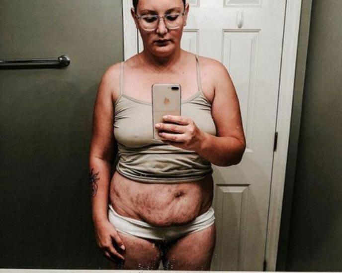 25 честных фотографий после родов, которыми делятся женщины, чтобы раскрыть правду честные фотографии после родов, женщины стали делиться честными фотографиями своих после рождения детей