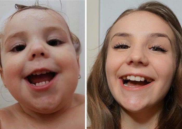 Люди делятся фотографиями с челленджа #10YearChallenge, и некоторых невозможно узнать Люди делятся фотографиями с челленджа #10YearChallenge, #10YearChallenge