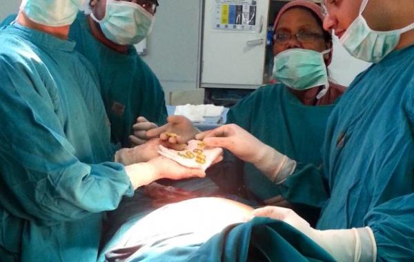 Индийские хирурги достали из живота 12 слитков золота