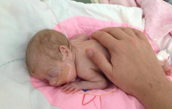 недоношенный ребёнок младенец, Эди Edie, родилась на 16 недель раньше