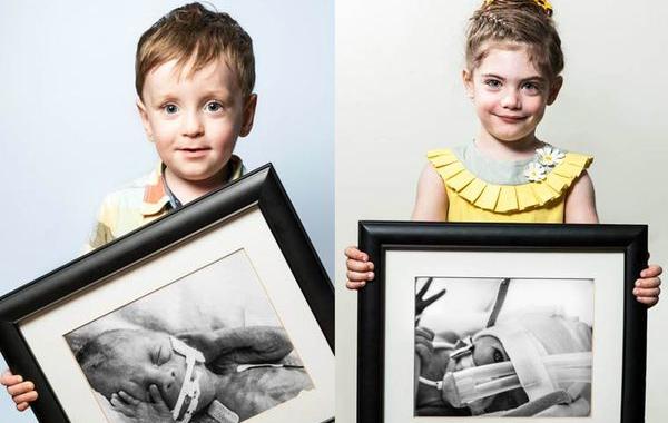 преждевременные, недоношенные дети фото сразу после рождения, недоношенные дети держат свои фото после рождения
