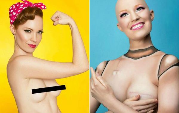 Аниела Макгиннесс, Aniela McGuinness, актриса сняла борьбу с раком груди, актриса сняла борьбу с раком молочной железы