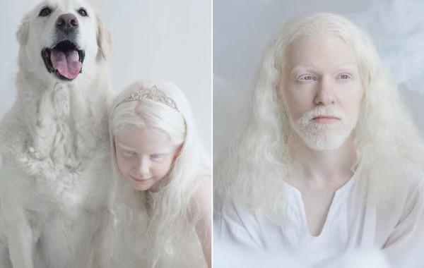 красота людей-альбиносов, Юлия Тайтс, Yulia Taits