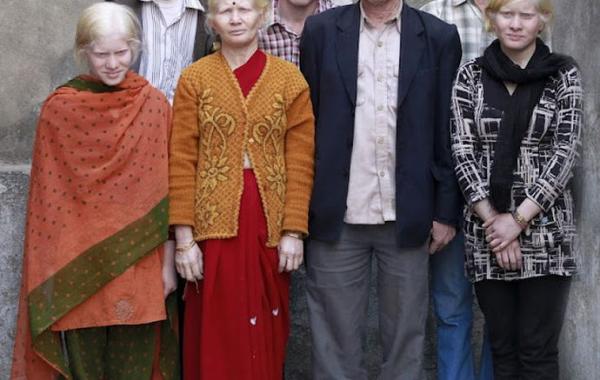 Семья альбиносов Пулланс из Индии, Pullans