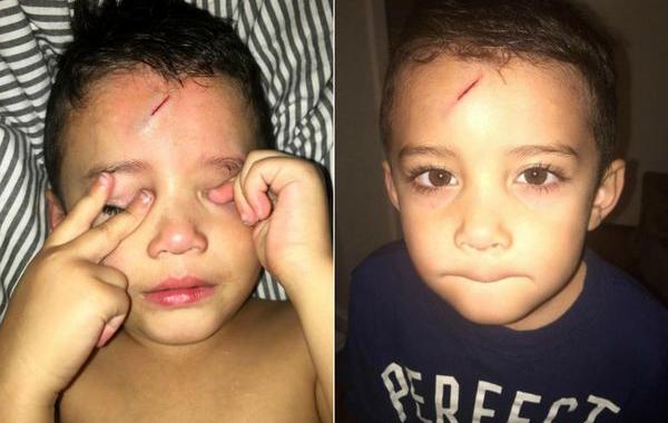 исправила ссадину сына, исправила ссадину на шрам Гарри Поттера, исправила ссадину знак Гарри Поттера, исправила ссадину сын гордился