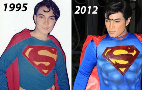 Филиппинец Герберт Чавес,Супермен, 13 операций