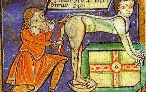 пугающие медицинские процедуры прошлого, операции средневековья