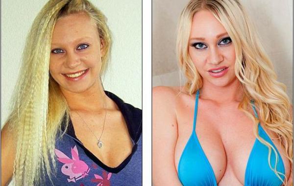  американка увеличила грудь за чужой счёт