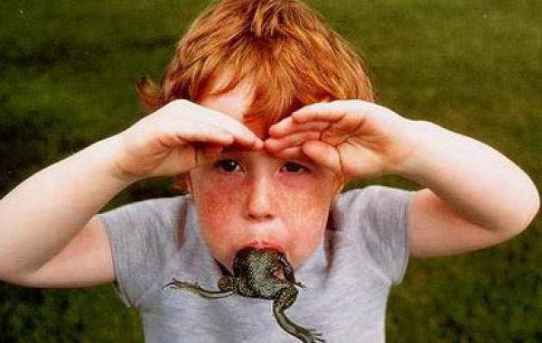 Самые необычные медицинские синдромы