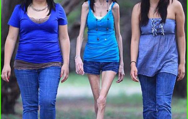 Сколько ест самая худая девушка в мире?