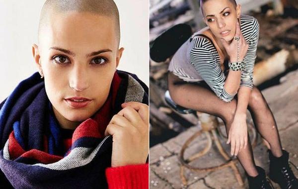 Дайна Кристисон, Dayna Christison, подписала модельный контракт на четвертой стадии рака, модель на четвертой стадии рака, модель 4 стадия рака