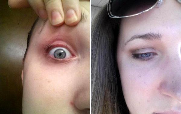 не стоит чихать во время завивки ресниц, девушка чихнула во время завивки ресниц