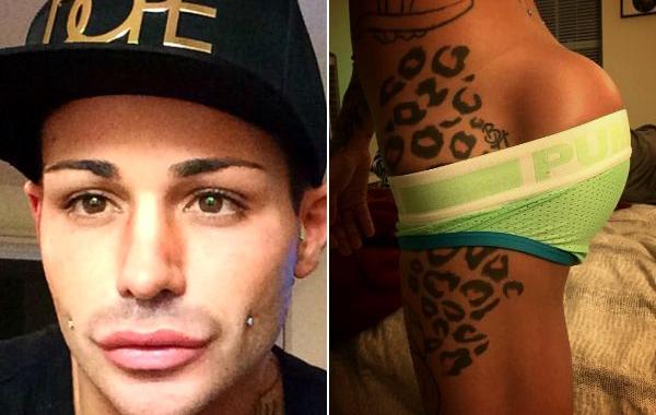 Джоуи Прикс, Joey Prixx, установил импланты в задницу, потратил 60000 долларов на идеальную задницу