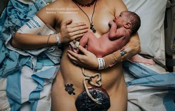 фото с конкурса фотографий родов, Birth Photo Competition 2017, через что проходят мамы, IAPBP