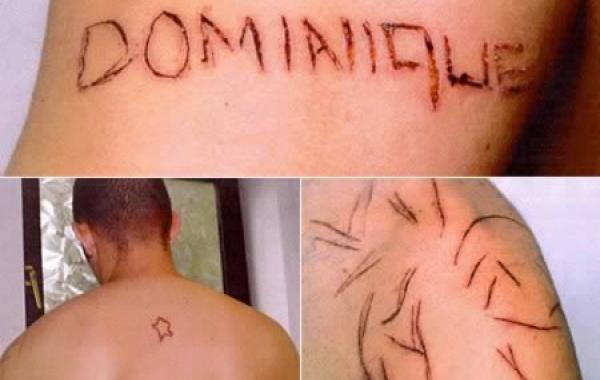 Истории самых ужасных последствий сильной пьянки