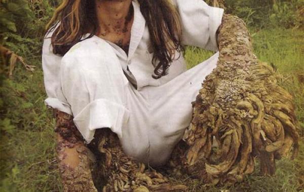 История человека - дерево