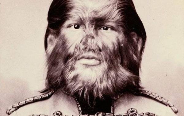 шоу уродов фрики викторианская эпоха Чарльз Эйзенманн charles eisenmann