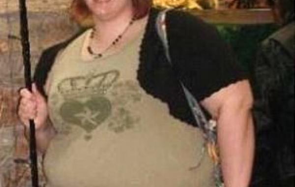 Девушка похудела на 80 кг и она не стесняется своего обвисшего тела