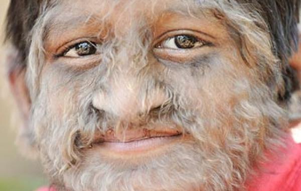 10 ошеломляющих медицинских историй